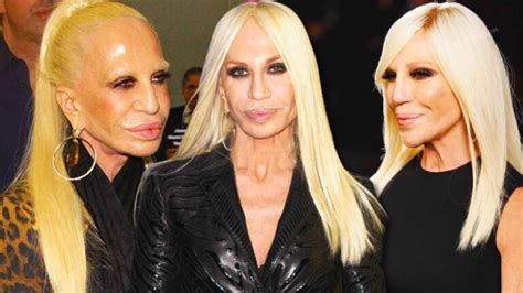 virgini raffaele donatella versace|donatella versace face what happened.